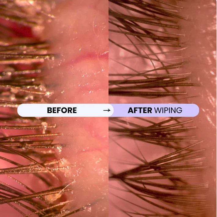Eye Lid Ritual Wipes - Daily Lid & Lash-Line Hygiene