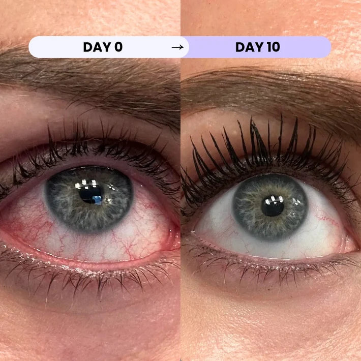 Eye Lid Ritual Wipes - Daily Lid & Lash-Line Hygiene