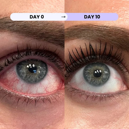 Eye Lid Ritual Wipes - Daily Lid & Lash-Line Hygiene