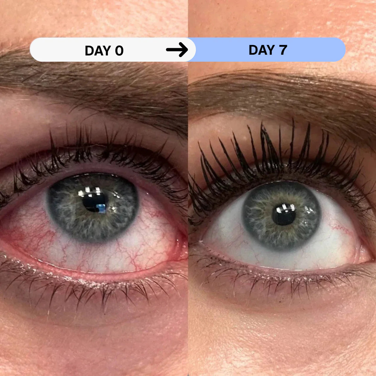 StimuRelief™ Eye Mask